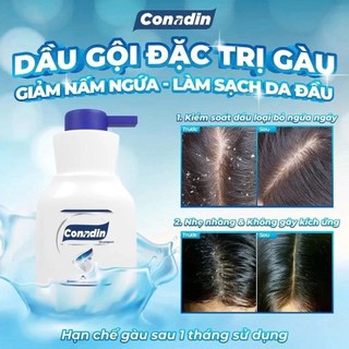 Dầu gội đầu Conadin Shampoo - Sạch Gàu, Giảm Nấm Tóc, Ngứa Da Đầu, Rụng Tóc 285ML