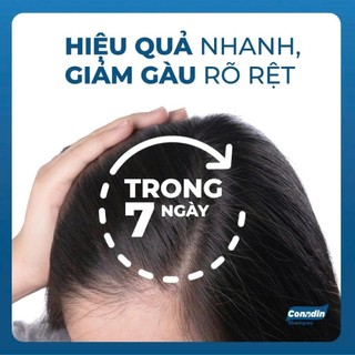 Dầu gội đầu Conadin Shampoo - Sạch Gàu, Giảm Nấm Tóc, Ngứa Da Đầu, Rụng Tóc 285ML