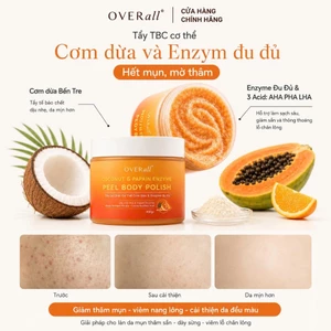 Tẩy Da Chết Cơ Thể Cơm Dừa & Enzyme Đu Đủ OVERall 300ml Giảm Mụn Viêm lỗ chân lông, Mờ Thâm