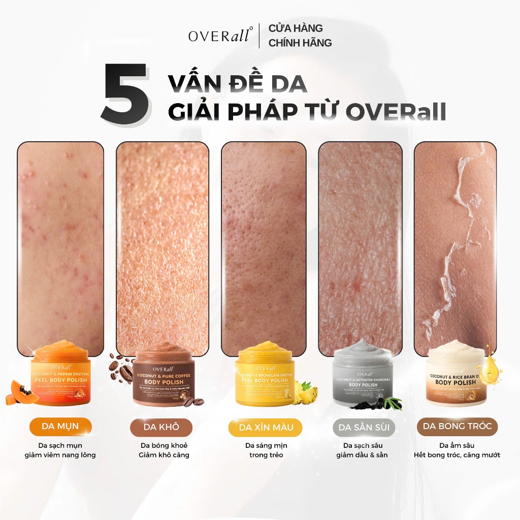 [OVR_01] Tẩy Da Chết Cơ Thể Cơm Dừa OVERall 300g Sáng da Mờ Thâm An toàn Giảm Mụn Viêm lỗ chân lông