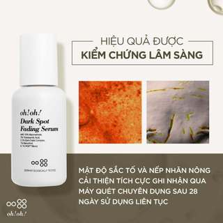Tinh Chất oh!oh! Dark Spot Fading Serum 30ml Kiểm Soát Sắc Tố Toàn Diện & Chống Lão Hóa 30ml
