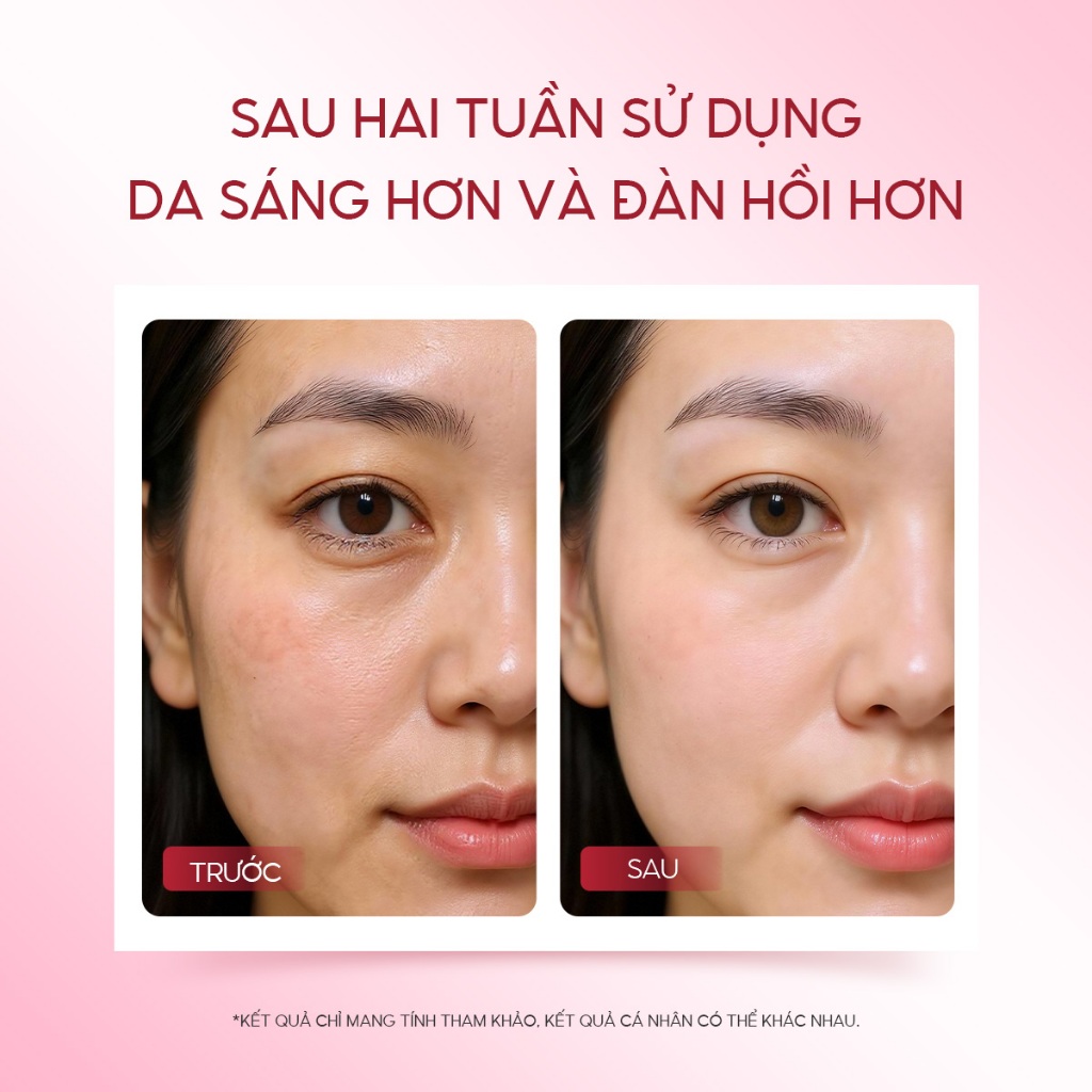 Combo Serum Retinol B3 và Hyalu-C The Originote chống lão hoá hỗ trợ sáng da cải thiện nếp nhăn