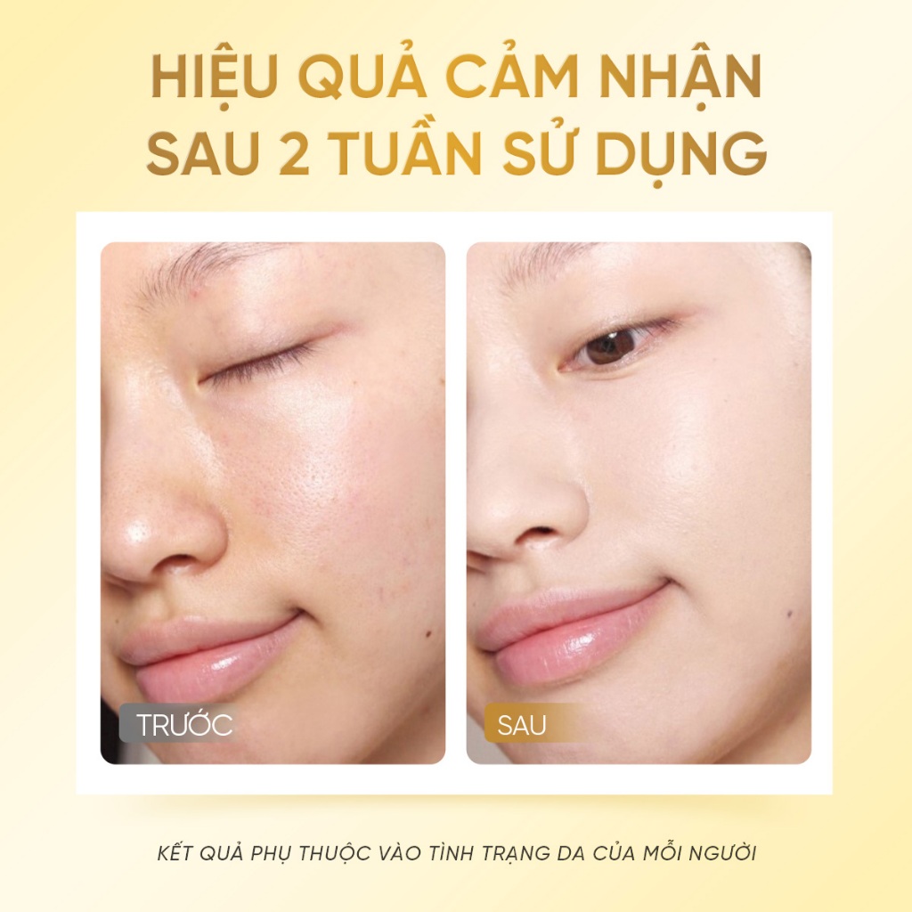 Combo Serum Retinol B3 và Hyalu-C The Originote chống lão hoá hỗ trợ sáng da cải thiện nếp nhăn