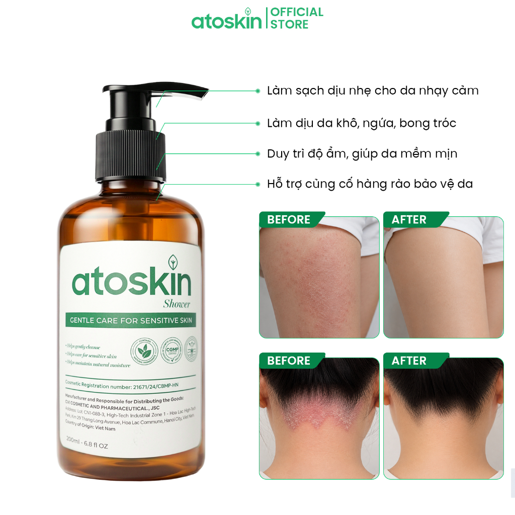 Sữa Tắm Viêm Da Cơ Địa Atoskin Shower 200ml - Hỗ Trợ Giảm Mẩn Đỏ, Giảm Ngứa Ngáy Giúp Da Khoẻ | BigBuy360 - bigbuy360.vn