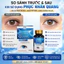 Viên Uống Bổ Mắt Phục Nhãn Quang - Hỗ Trợ Cải Thiện Thị Lực, Giảm Mỏi Mắt & Ngăn Ngừa Thoái Hóa Điểm Vàng-Hộp 30v