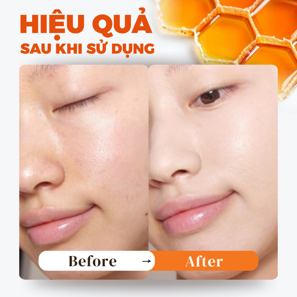 Tẩy tế bào chết da mặt BLANICA chiết xuất mật ong lên men hỗ trợ làn da mịn màng trắng sáng 120g