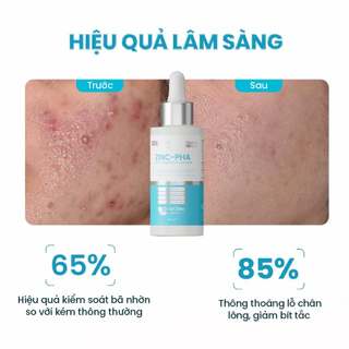 Serum MD CARE Kiểm Soát Dầu, Làm Dịu Mụn ZINC PHA Serum Regulation Complex (30ml)