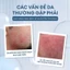 Kem dưỡng sau cạo Men Stay Simplicity Ultra Cool After Shave Lotion giảm đỏ rát mát lạnh 100ml