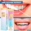 Kem Đánh Răng niacinamide Làm Trắng Bảo Vệ Răng Loại Bỏ Vết Bẩn 100G Làm mới hơi thở và chăm sóc răng miệng