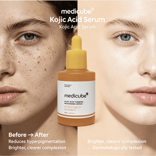 Medicube Kojic Acid Nghệ Niacinamide Serum 30ml