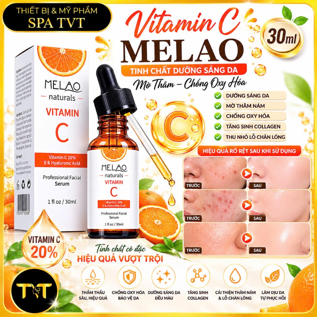 VITAMIN C MELAO 30ML & VITAMIN C HÀN QUỐC 5 VỈ X 10 ỐNG – HỖ TRỢ SÁNG DA, GIẢM THÂM, TĂNG ĐÀN HỒI