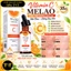 Vitamin C Melao 30ml Hỗ Trợ Làm Sáng Da, Mờ Thâm, Chống Oxy Hóa, Cải Thiện Da Xỉn Màu & Lão Hóa
