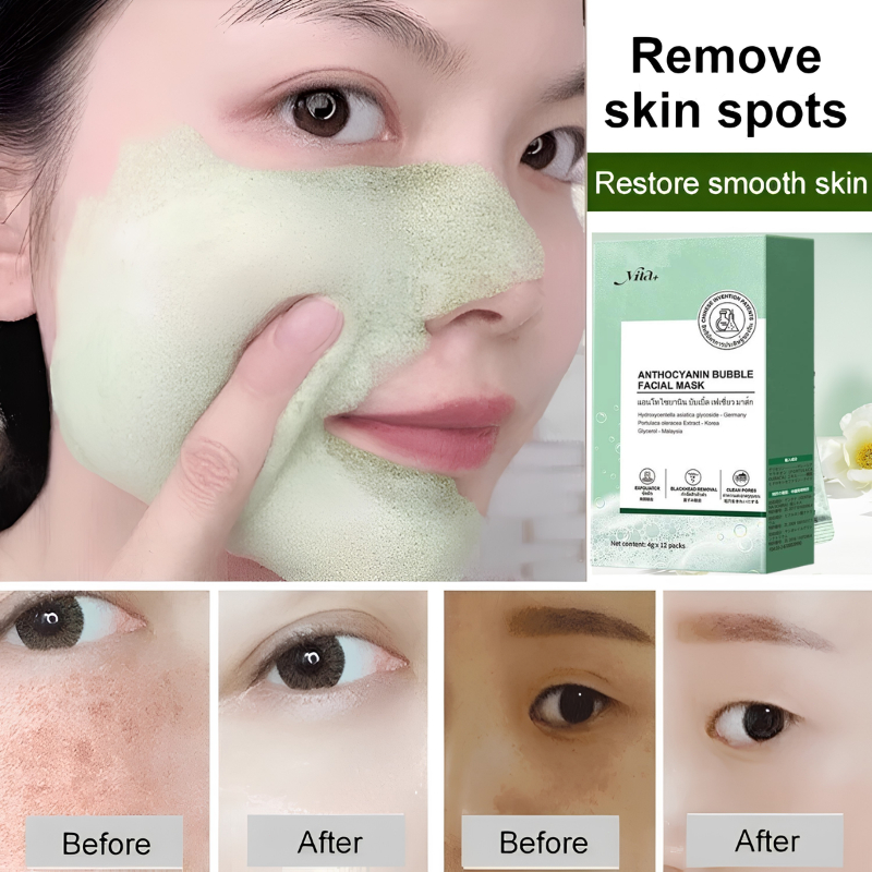 【CấP ẨM Sâu】 Mặt nạ bong bóng Anthocyanin Dưưỡng Da Không Khô Rát sạch sâu Kiểm soát dầu dưỡng ẩm B3