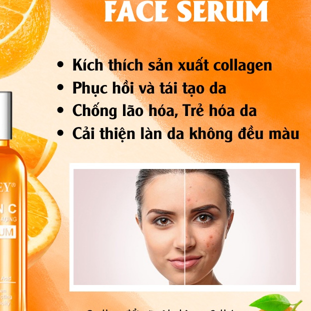 Serum Dưỡng Da Vitamin C Face Serum Dissaar Giảm Sạm Da, Chống Lão Hóa Kích Thích Sản Xuất Collagen