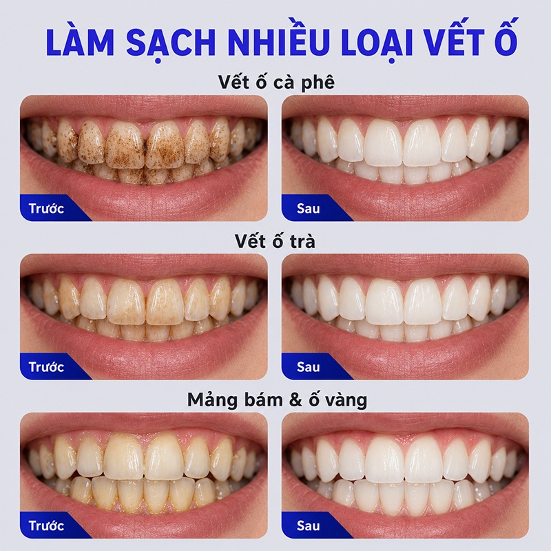 Kem Đánh Răng Làm Trắng Răng, Loại Bỏ Vết Cà Phê Vết Trà, Giảm Ố Vàng Răng, Hơi Thở Thơm Mát, LYDIMOON, 100g