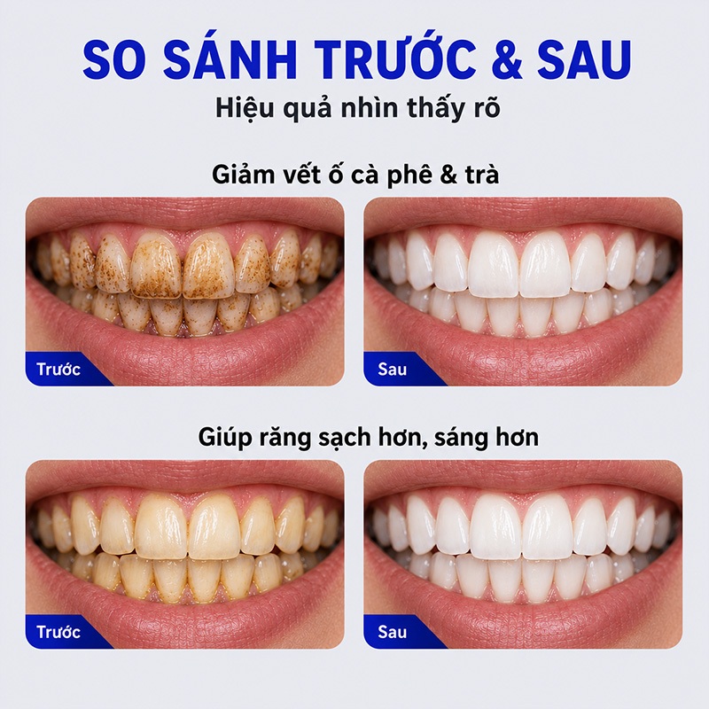 Kem Đánh Răng Làm Trắng Răng, Loại Bỏ Vết Cà Phê Vết Trà, Giảm Ố Vàng Răng, Hơi Thở Thơm Mát, LYDIMOON, 100g