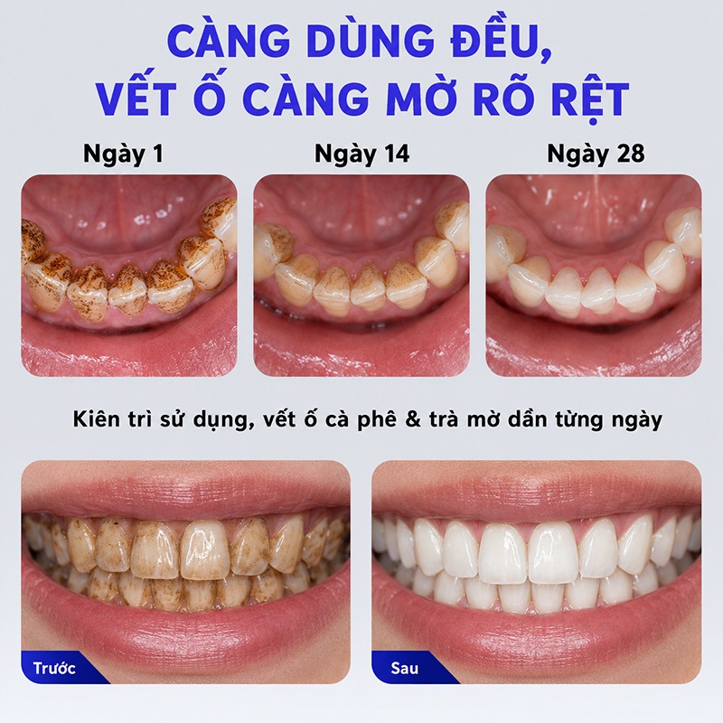 Kem Đánh Răng Làm Trắng Răng, Loại Bỏ Vết Cà Phê Vết Trà, Giảm Ố Vàng Răng, Hơi Thở Thơm Mát, LYDIMOON, 100g