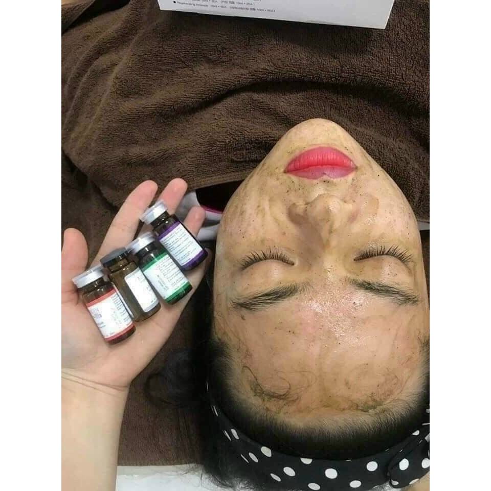 ULTRA V PEEL, BTOX PEEL 2 MÀU, BTOX PEEL 4 MÀU, THAY DA SINH HỌC, GIẢM MỤN, THÂM NÁM