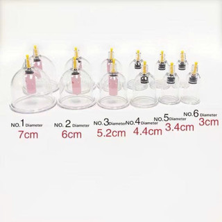 BỘ GIÁC HƠI 12 ỐNG HÚT CHÂN KHÔNG KHÔNG DÙNG LỬA