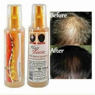 XỊT KÍCH THÍCH MỌC TÓC CHỐNG HÓI GENIVE HAIR TONIC CHUẨN THÁI