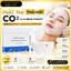 BỘ CO2 CARBON THERAPY DJ HÀN QUỐC, THẢI ĐỘC DA, GIẢM MỤN, SÁNG DA, CĂNG BÓNG DA
