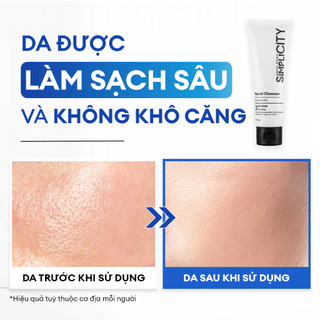 Sữa Rửa Mặt Nam Men Stay Simplicity Ngừa Mụn Giảm Dầu Nhờn 100g