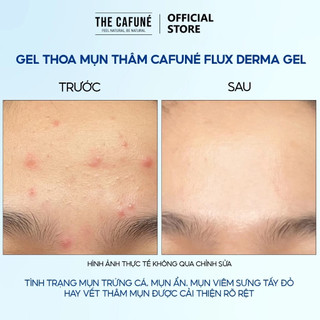 Gel Giảm Mụn Và Thâm the Cafuné Flux Derma Gel 20gram