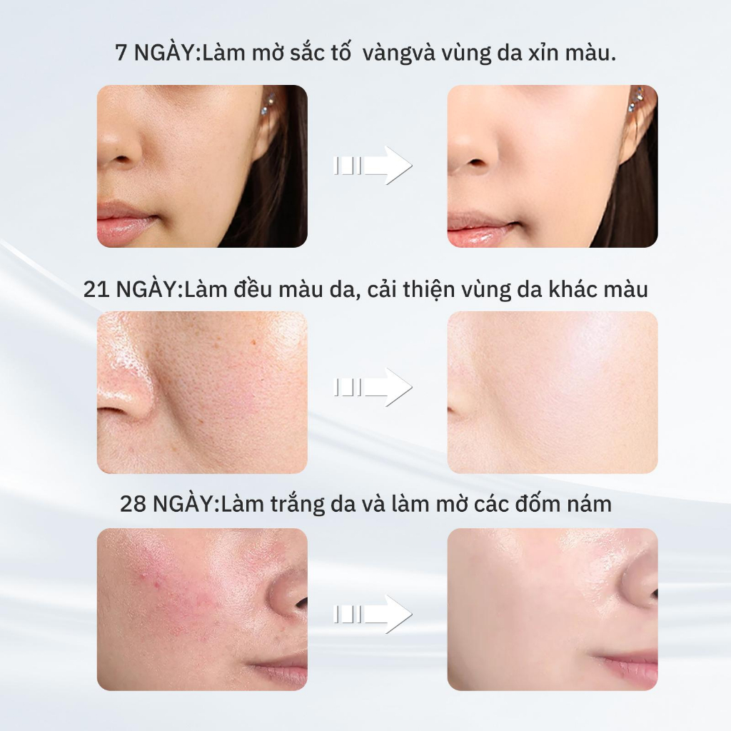 【Amtn】 Kem dưỡng da mặt trắng sáng, da mềm mịn, cấp ẩm chuyên sâu 50g, cải thiện làn da xỉn màu, dưỡng trắng mặt, phục h