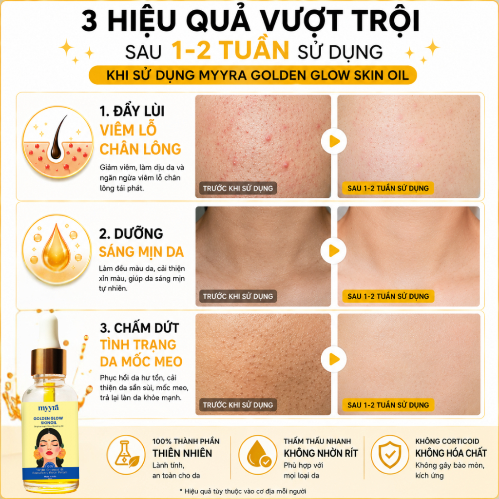 DẦU DƯỠNG SÁNG DA GIẢM THÂM Ấn Độ, căng bóng và ẩm mượt, đều màu da tức thì, hương hoa hồng thơm lâu
