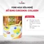 Sữa Bột Fobemilk Nghệ Fobe Hỗ Trợ Tiêu Hóa, Bảo Vệ Dạ Dày Khỏe Mạnh - Lon 700g