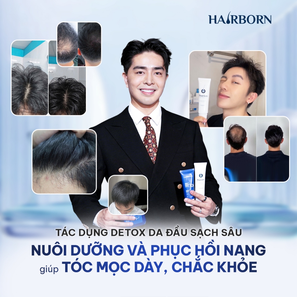 Peel Lăn Tóc HairBorn 60ml - Hỗ Trợ Giảm Rụng, Kích Thích Mọc Tóc Cho Nam Và Nữ