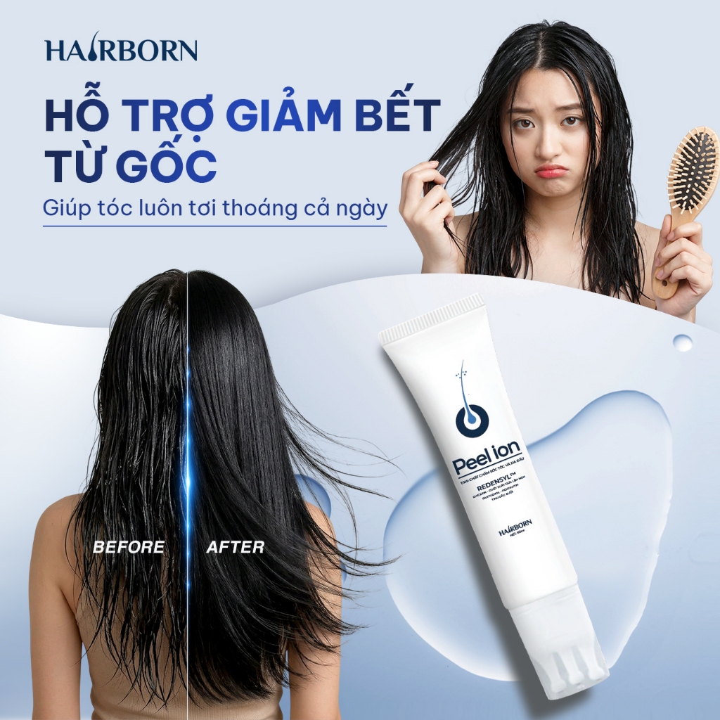 Peel Lăn Tóc HairBorn 60ml - Hỗ Trợ Giảm Rụng, Kích Thích Mọc Tóc Cho Nam Và Nữ