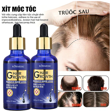 xịt bưởi mọc tócTinh chất mọc tóc tinh dầu mọc tóc 50ml serum kích mọc tóc chăm sóc tóc chống rụng tóc,kích thích