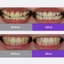 Kem đánh răng Euthymol Whitening thế hệ mới ngăn ngừa ố vàng, đem lại cảm giác sảng khoái