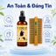 Bộ Đôi Xịt Và Lược Sạch Chấy Gia Truyền Cụ Năm Ngân Bình Cho Bé - Hỗ Trợ Làm Sạch Chấy, Trứng Chí Hiệu Quả