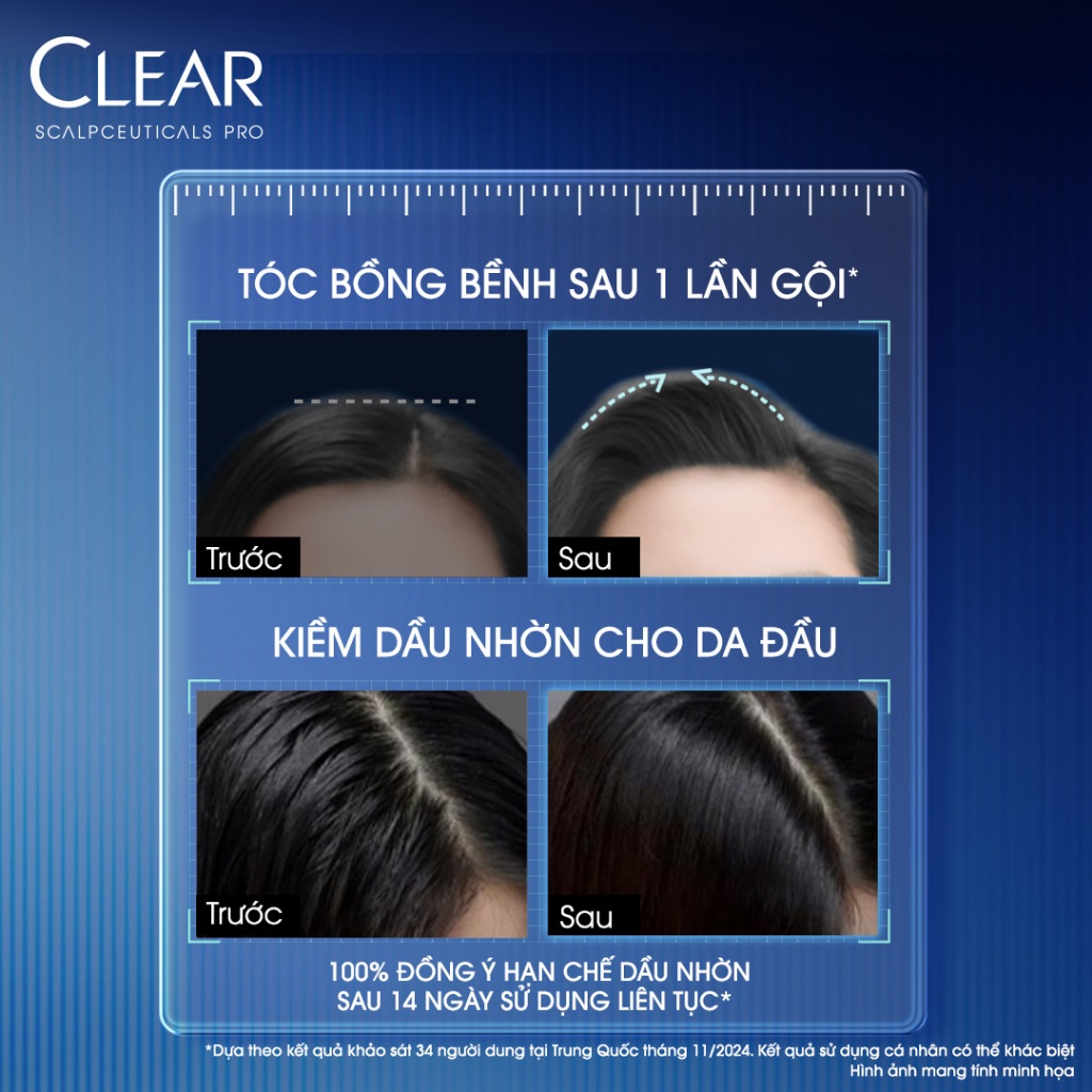 Dầu gội kiềm dầu nhờn Clear Scalpceuticals Pro Sebum Control 300G