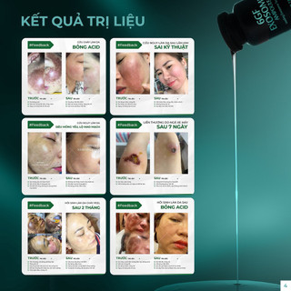 Tế Bào Gốc 6GF Medula Exosome Chống lão Hoá Và Trẻ Hoá Da.