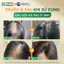 Dầu Gội Hà Thủ Ô 2in1 Cỏ Cây Hoa Lá - Hỗ Trợ Mọc Tóc, Giảm Rụng Tóc, Dưỡng Tóc Chắc Khỏe