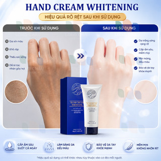 Kem Dưỡng Da Tay Soyraié Hand Cream Whitening 100g - Dưỡng Ẩm Da Tay, Làm Mềm Da, Hỗ Trợ Da Tay Mịn Màng