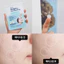 Miếng Dán Mụn Olive Young Care Plus Scar Cover Spot Patch