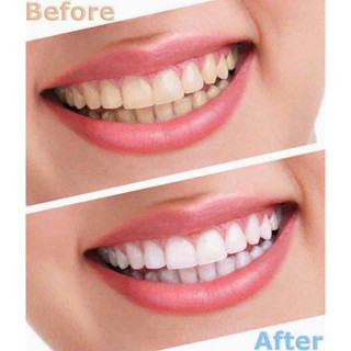 Kem đánh răng Crest - dòng 3D White - Pro Advanced Whitening