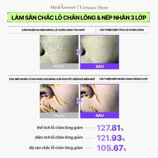 Mặt Nạ Thạch Retinol Tím Nâng Cơ Combo Hộp 4 Mặt Nạ MediAnswer Retinoid Liftxyl Mask Săn Chắc Da 43g - Skinora Beauty