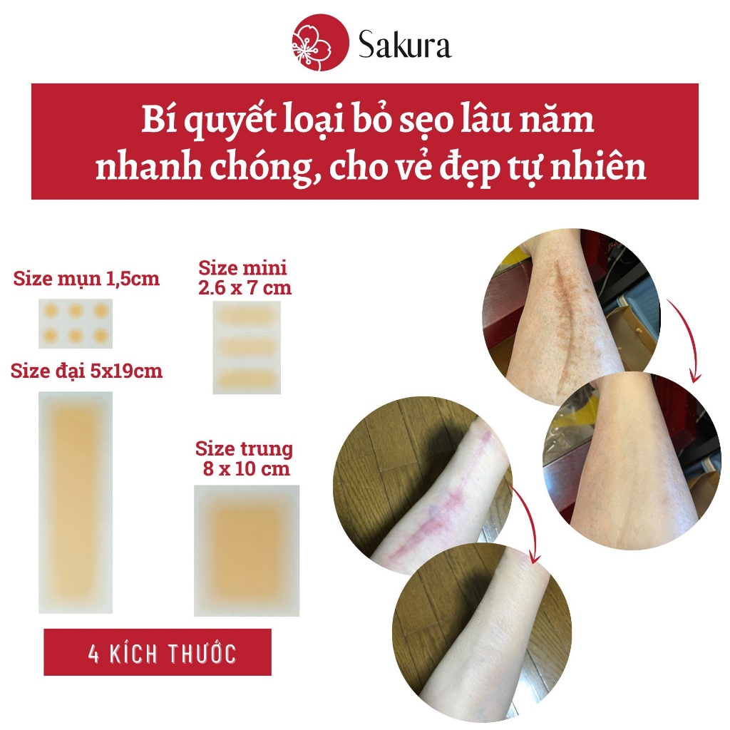 Miếng dán che sẹo lâu năm Japan siêu mỏng chống nước, nhiều màu đa dang kích thước