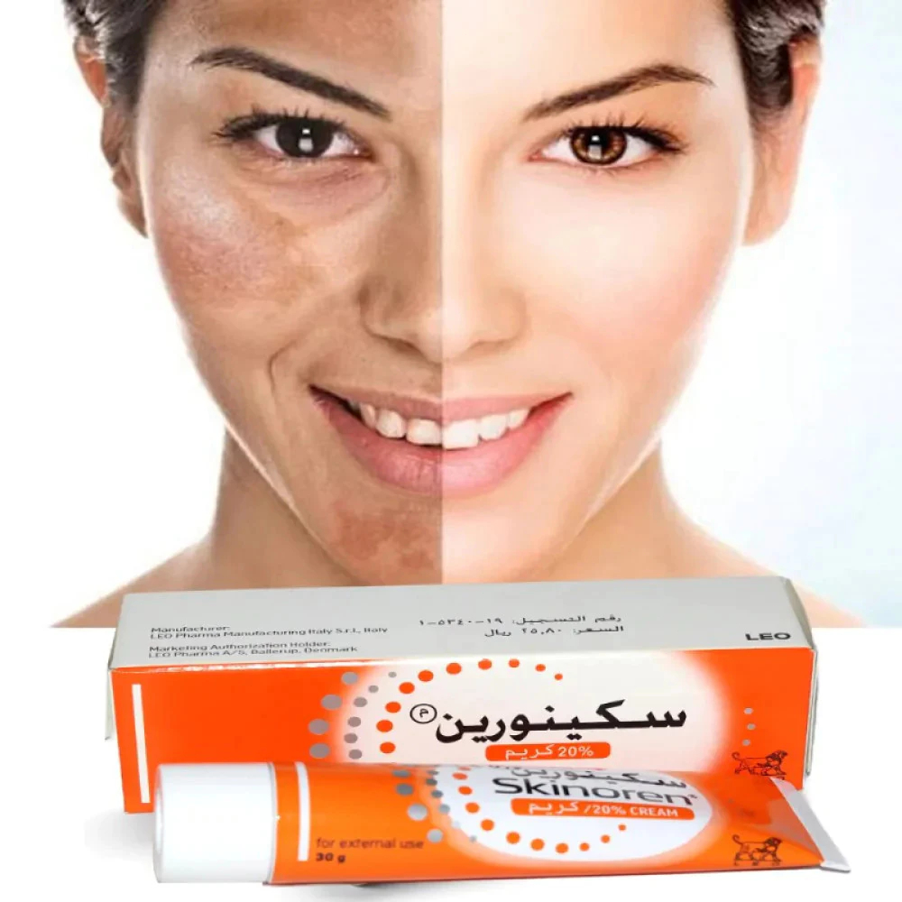Kem Skinoren Azelaic Acid 20% 30g/Chăm Sóc Da Hàng Đức