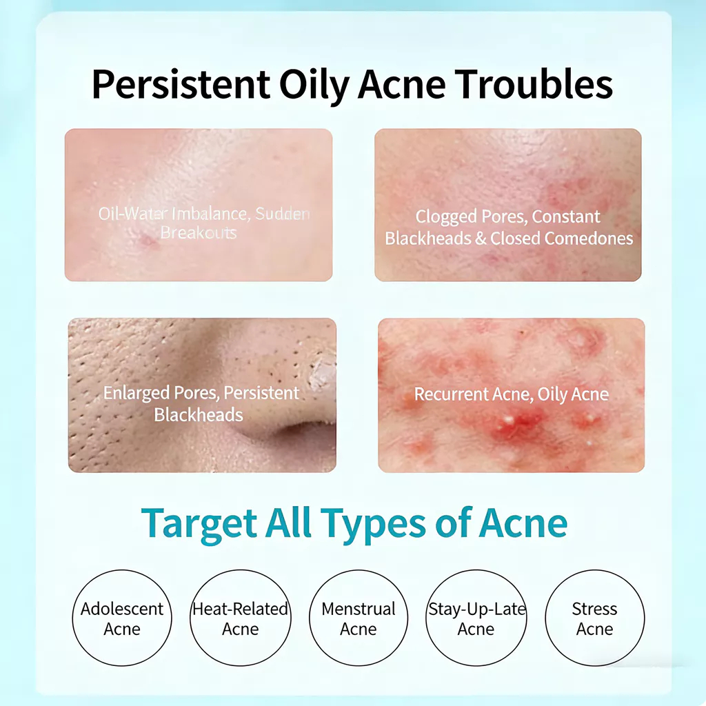 Kem Skinoren Azelaic Acid 20% 30g/Chăm Sóc Da Hàng Đức