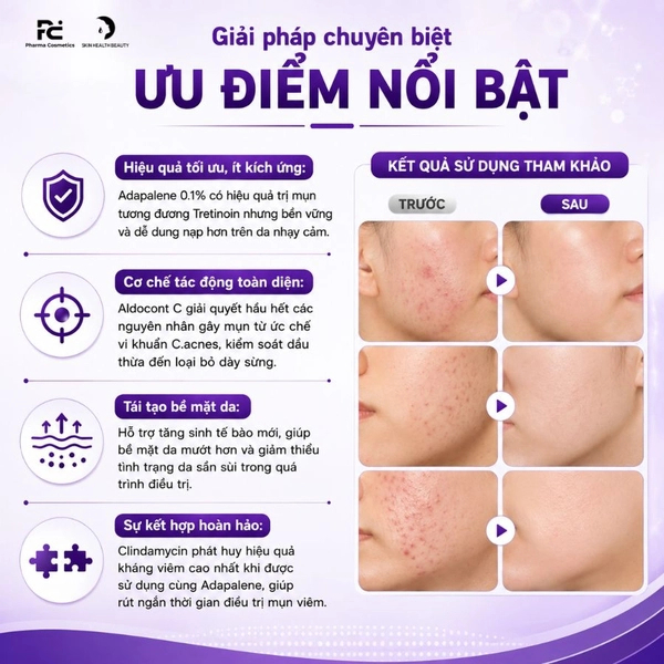 Mụn Aldocont C Adapalene Gel Giảm Mụn Bọc Mụn Viêm Dành Cho Da Nhạy Cảm Gel 15g