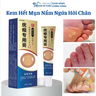 Kem Bôi Đánh Bay Mụn Cóc, Mụn Thịt Nấm Ngứa Chân Tay