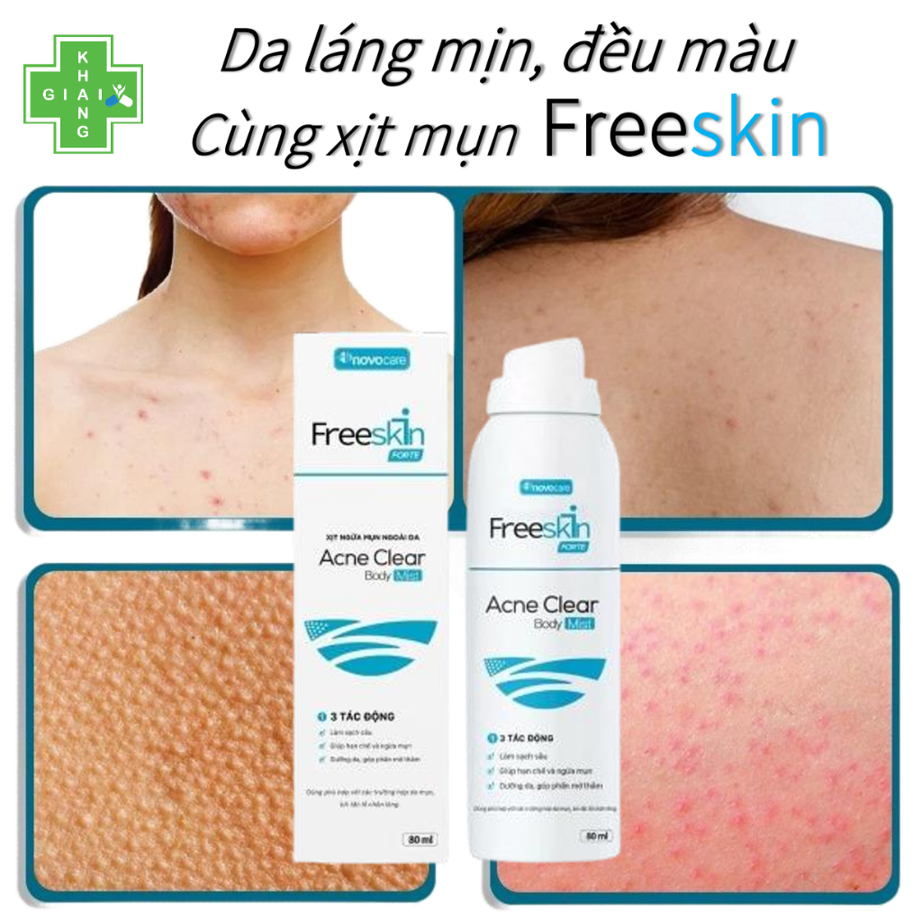 Tạm biệt mụn cơ thể, trả lại làn da láng mịn, đều màu cùng xịt mụn body Freeskin (Chai 80ml)