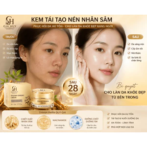 Kem Tái Tạo Da Nhân Sâm Cao Cấp Golden Ginseng Cream – Peel Da, Phục Hồi Da Hư Tổn, Trắng Sáng Mịn Màng