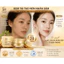 Kem Tái Tạo Da Nhân Sâm Cao Cấp Golden Ginseng Cream – Peel Da, Phục Hồi Da Hư Tổn, Trắng Sáng Mịn Màng